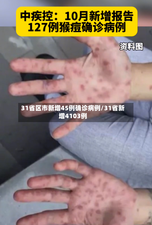 31省区市新增45例确诊病例/31省新增4103例-第2张图片